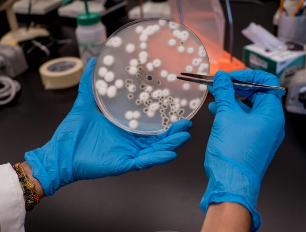 Schim­mel in der Lüf­tungs­an­la­ge: Ent­fer­nen von Kei­men und Bak­te­ri­en